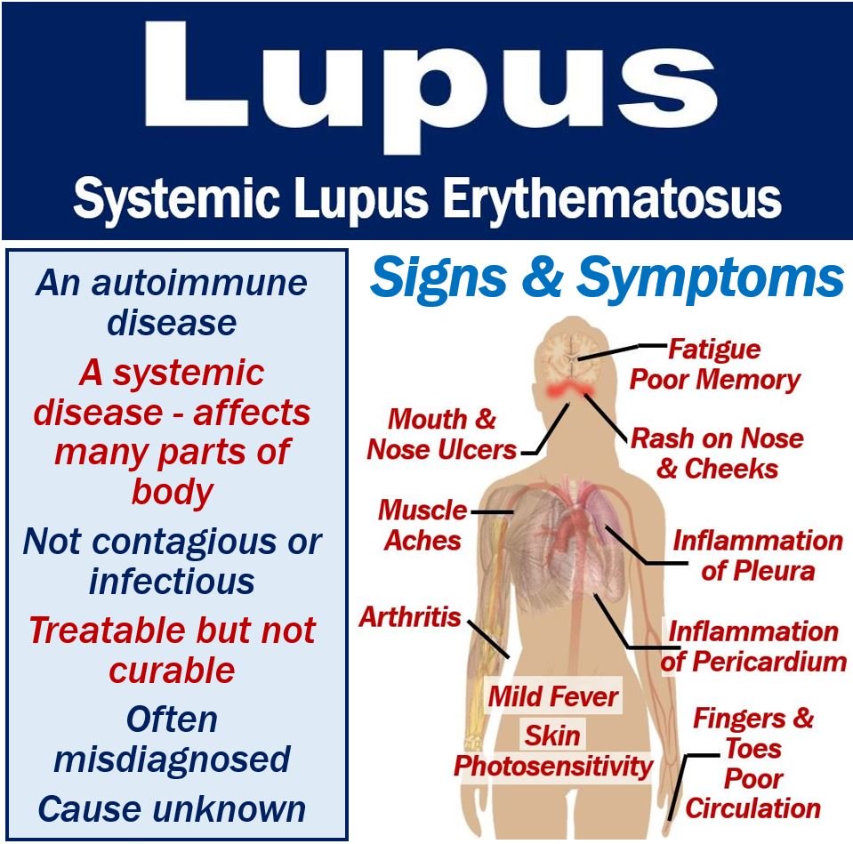 lupus pictures symptoms